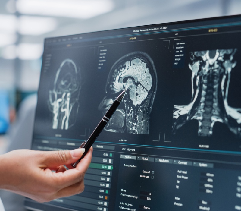 A doctor looking at the results of an MRI scan.